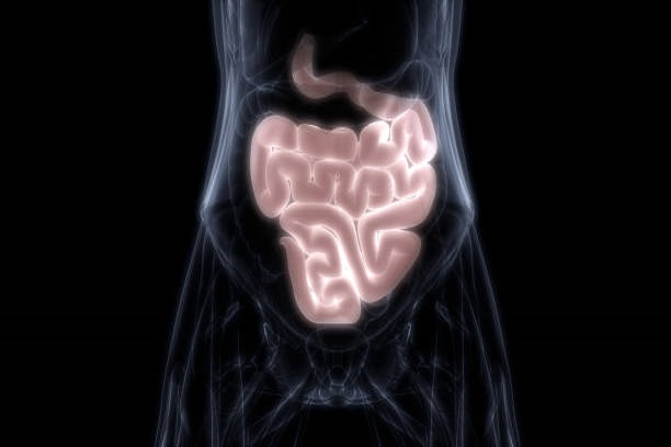 Mengenal Asites Perut Penyebab, Gejala, dan Pengobatan